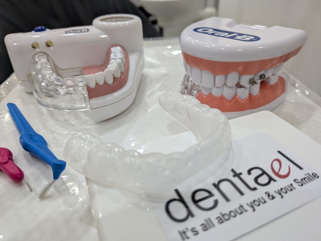 Custom mouthguards