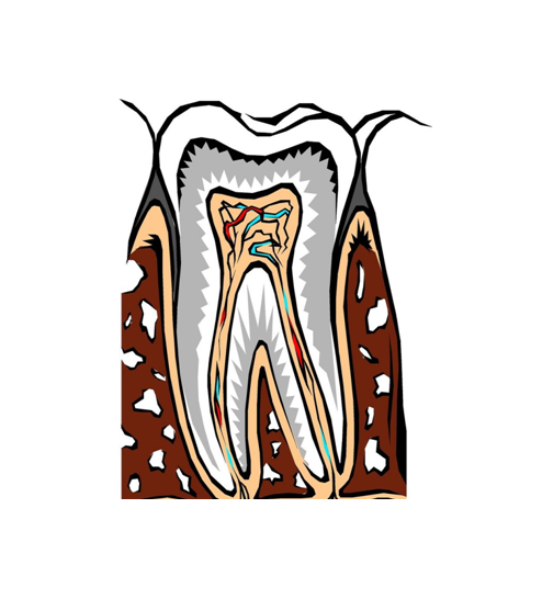 Tooth extractions