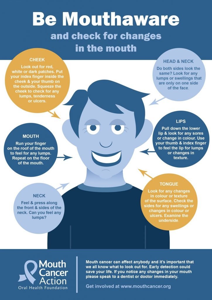 How to self check for mouth cancer