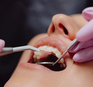 Dental check up with experienced dentist