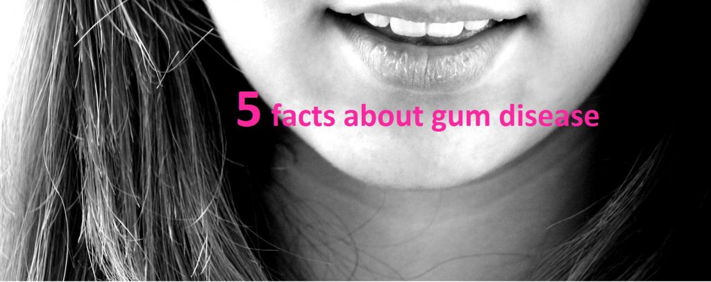 Facts about gum disease and periodontal health