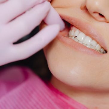 Missing tooth replacement options
