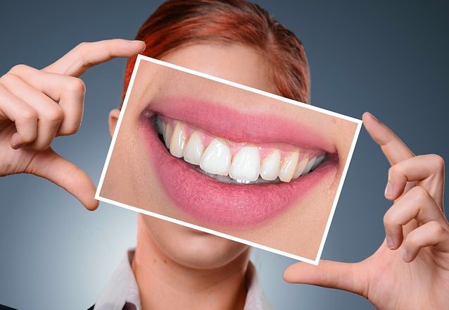 Benefits of a healthy smile