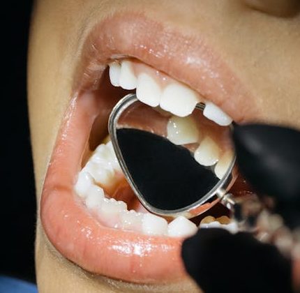 Tooth decay causes symptoms and treatment