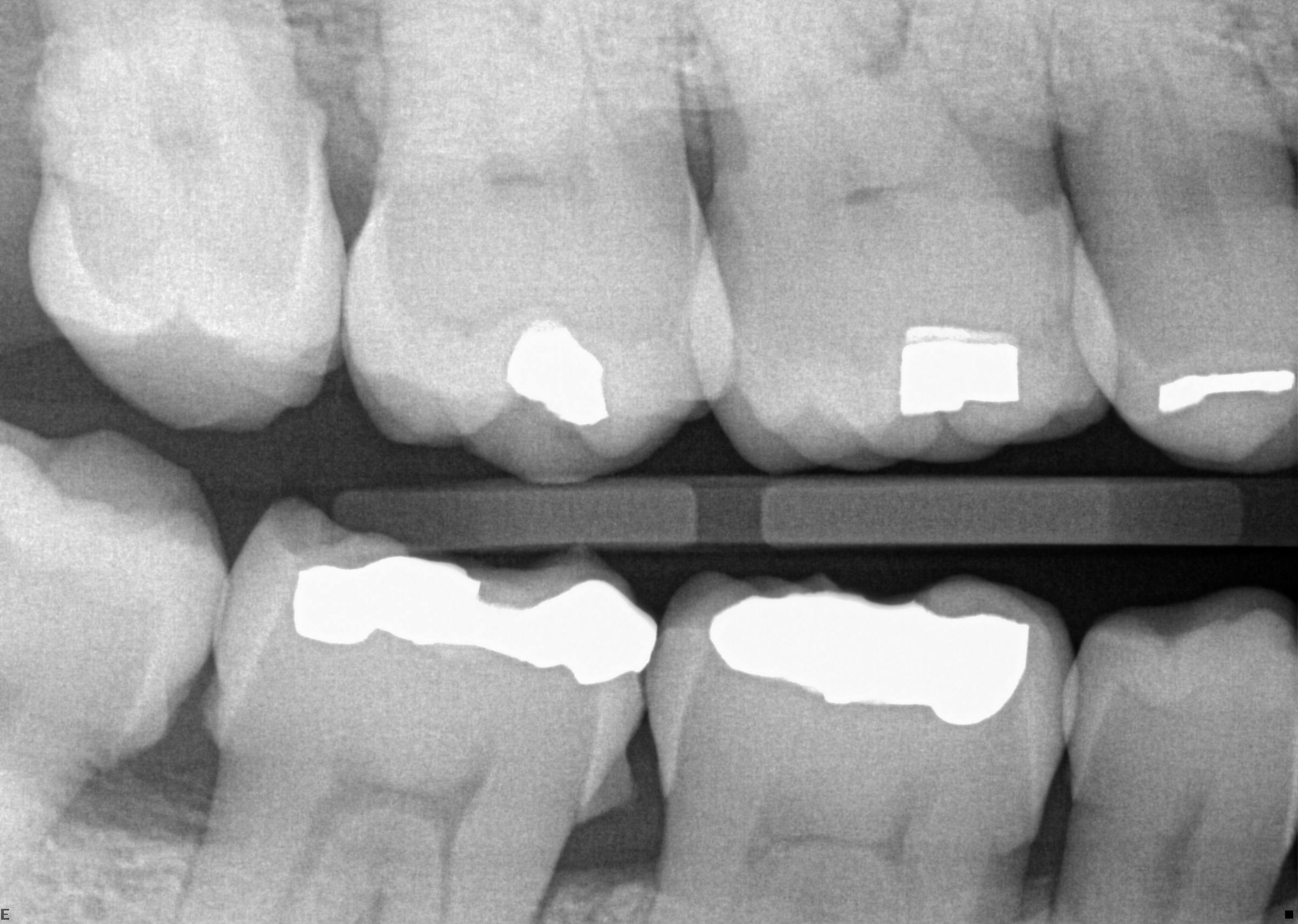 Digital dental x-ray technology