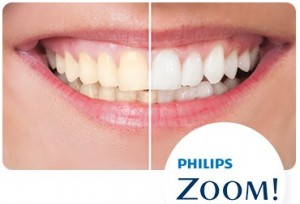 philips zoom teeth whitening