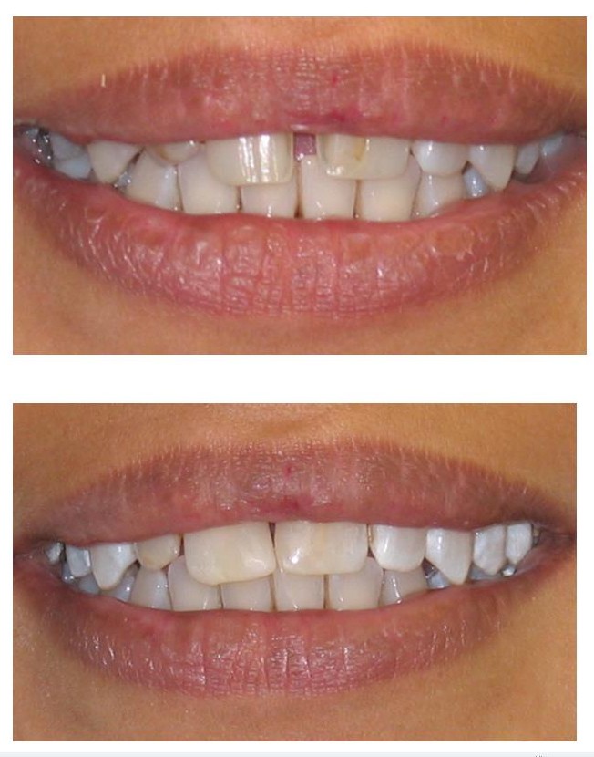 Cosmetic Dentistry Greenford- dentael