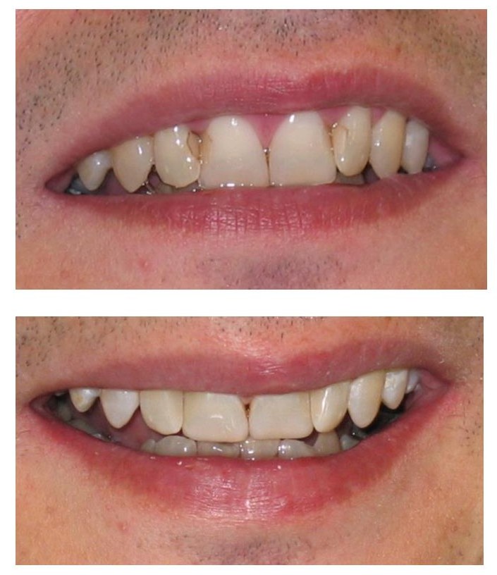 Cosmetic Dentistry Southall - dentael dental clinic