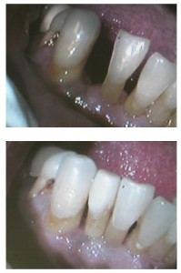 cosmetic dentistry greenford - dentael