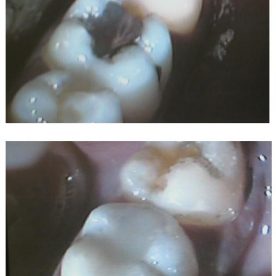 Cosmetic Dentistry Greenford - dentael