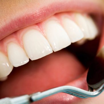 Why Preventive Dental Care Matters