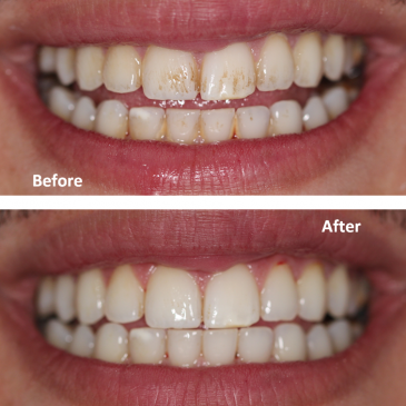 Dental Hygiene Services near you