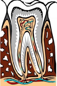 root canal treatment dentist near